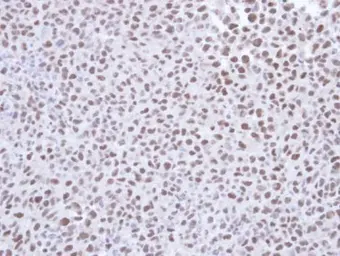 Anti-SMC1A antibody [C1C2], Internal used in IHC (Paraffin sections) (IHC-P). GTX110331
