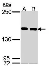 Anti-SMC1A antibody [C1C2], Internal used in Western Blot (WB). GTX110331