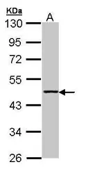 Anti-Aminoacylase 1 antibody [N2C3-2] used in Western Blot (WB). GTX110348
