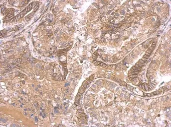 Anti-Ihh antibody used in IHC (Paraffin sections) (IHC-P). GTX110355