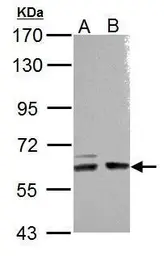 Anti-ARHGEF9 antibody [N2C2-2], Internal used in Western Blot (WB). GTX110357