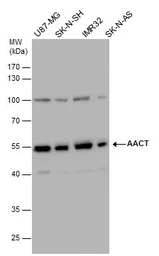Anti-alpha 1 Antichymotrypsin antibody used in Western Blot (WB). GTX110359