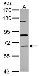 Anti-ACOX1 antibody [N2C2], Internal used in Western Blot (WB). GTX110372