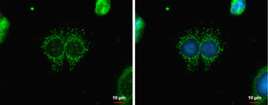 Anti-CABC1 antibody [N3C2], Internal used in Immunocytochemistry/ Immunofluorescence (ICC/IF). GTX110374