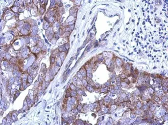 Anti-CABC1 antibody [N3C2], Internal used in IHC (Paraffin sections) (IHC-P). GTX110374