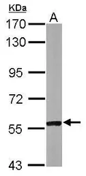 Anti-CABC1 antibody [N3C2], Internal used in Western Blot (WB). GTX110374