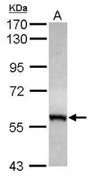 Anti-CABC1 antibody [N3C2], Internal used in Western Blot (WB). GTX110374