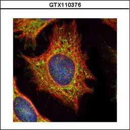 Anti-Xylosyltransferase II antibody [N2C1], Internal used in Immunocytochemistry/ Immunofluorescence (ICC/IF). GTX110376