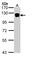 Anti-Xylosyltransferase II antibody [N2C1], Internal used in Western Blot (WB). GTX110376