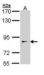 Anti-BBS12 antibody [C1C3] used in Western Blot (WB). GTX110388