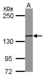 Anti-SMC3 antibody [C2C3], C-term used in Western Blot (WB). GTX110402