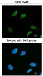 Anti-SMC3 antibody [C2C3], C-term used in Immunocytochemistry/ Immunofluorescence (ICC/IF). GTX110402