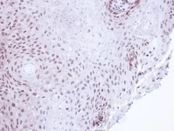 Anti-SMC3 antibody [C2C3], C-term used in IHC (Paraffin sections) (IHC-P). GTX110402