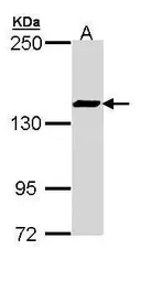 Anti-SMC3 antibody [C2C3], C-term used in Western Blot (WB). GTX110402
