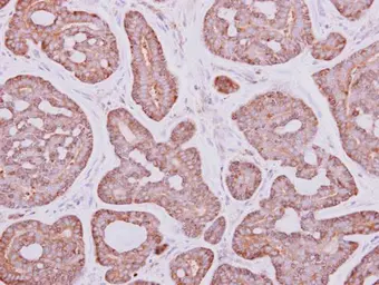 Anti-PYGM antibody [C1C3] used in IHC (Paraffin sections) (IHC-P). GTX110411
