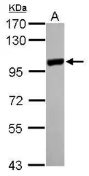 Anti-PYGM antibody [C1C3] used in Western Blot (WB). GTX110411