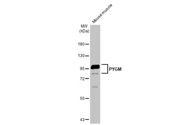 Anti-PYGM antibody [C1C3] used in Western Blot (WB). GTX110411