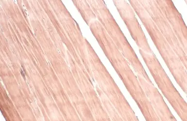 Anti-PYGM antibody [C1C3] used in IHC (Paraffin sections) (IHC-P). GTX110411