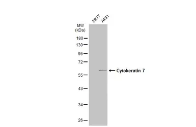 Anti-Cytokeratin 7 antibody [N2C2], Internal used in Western Blot (WB). GTX110414