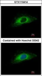 Anti-Cytokeratin 7 antibody [N2C2], Internal used in Immunocytochemistry/ Immunofluorescence (ICC/IF). GTX110414