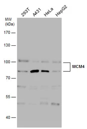 Anti-MCM4 antibody used in Western Blot (WB). GTX110424