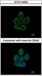 Anti-alpha Tubulin 8 antibody [N1C1-2] used in Immunocytochemistry/ Immunofluorescence (ICC/IF). GTX110432