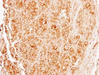 Anti-alpha Tubulin 8 antibody [N1C1-2] used in IHC (Paraffin sections) (IHC-P). GTX110432