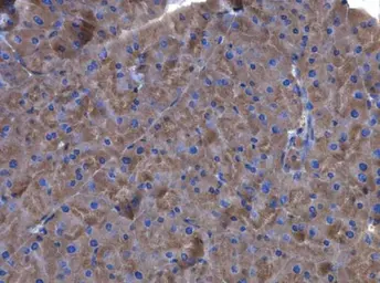 Anti-Factor XIIIa antibody [N1N3] used in IHC (Paraffin sections) (IHC-P). GTX110434