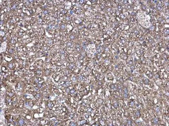 Anti-Factor XIIIa antibody [N1N3] used in IHC (Paraffin sections) (IHC-P). GTX110434
