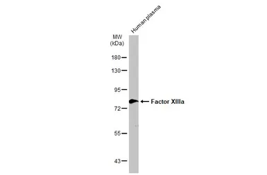 Anti-Factor XIIIa antibody [N1N3] used in Western Blot (WB). GTX110434