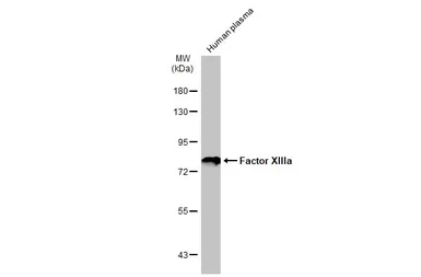 Anti-Factor XIIIa antibody [N1N3] used in Western Blot (WB). GTX110434