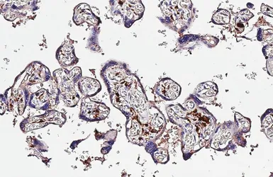 Anti-Factor XIIIa antibody [N1N3] used in IHC (Paraffin sections) (IHC-P). GTX110434