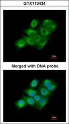 Anti-Factor XIIIa antibody [N1N3] used in Immunocytochemistry/ Immunofluorescence (ICC/IF). GTX110434