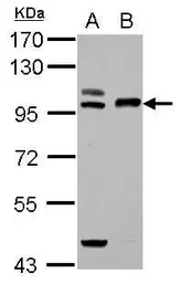 Anti-TFR2 antibody [N3C2], Internal used in Western Blot (WB). GTX110441