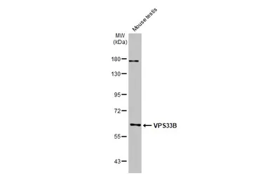 Anti-VPS33B antibody [N3C2], Internal used in Western Blot (WB). GTX110467