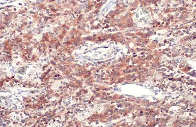 Anti-CD74 antibody [N1N2], N-term used in IHC (Paraffin sections) (IHC-P). GTX110477