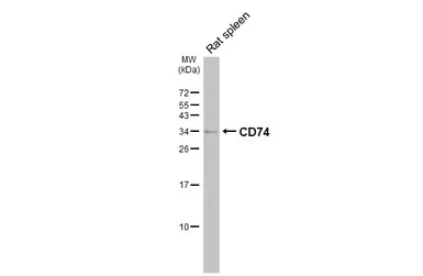 Anti-CD74 antibody [N1N2], N-term used in Western Blot (WB). GTX110477