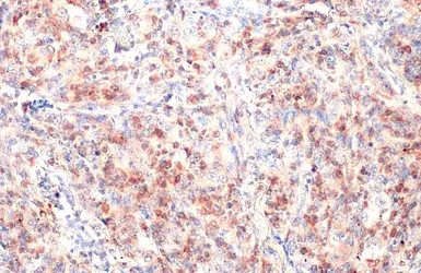 Anti-CD74 antibody [N1N2], N-term used in IHC (Paraffin sections) (IHC-P). GTX110477