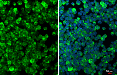 Anti-CD74 antibody [N1N2], N-term used in Immunocytochemistry/ Immunofluorescence (ICC/IF). GTX110477