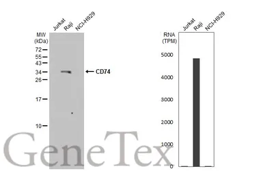 Anti-CD74 antibody [N1N2], N-term used in Western Blot (WB). GTX110477