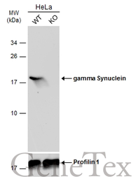 Anti-gamma Synuclein antibody used in Western Blot (WB). GTX110483
