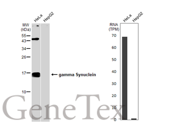 Anti-gamma Synuclein antibody used in Western Blot (WB). GTX110483