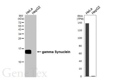 Anti-gamma Synuclein antibody used in Western Blot (WB). GTX110483
