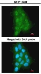 Anti-MAGEA11 antibody [N2N3] used in Immunocytochemistry/ Immunofluorescence (ICC/IF). GTX110484