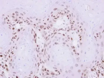 Anti-MAGEA11 antibody [N2N3] used in IHC (Paraffin sections) (IHC-P). GTX110484