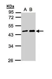 Anti-MAGEA11 antibody [N2N3] used in Western Blot (WB). GTX110484