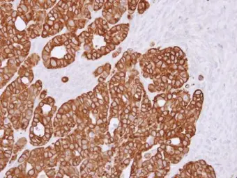 Anti-RGS11 antibody [N2C1], Internal used in IHC (Paraffin sections) (IHC-P). GTX110490
