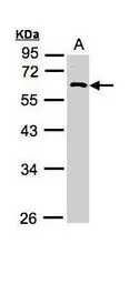 Anti-RGS11 antibody [N2C1], Internal used in Western Blot (WB). GTX110490