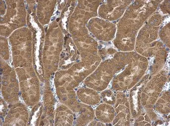 Anti-FRAT1 antibody [C2C3], C-term used in IHC (Paraffin sections) (IHC-P). GTX110492