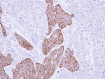 Anti-FRAT1 antibody [C2C3], C-term used in IHC (Paraffin sections) (IHC-P). GTX110492
